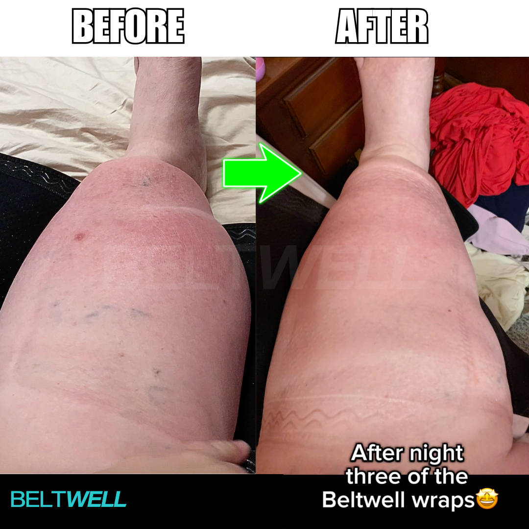 Beltwell® Calf Compression Wrap